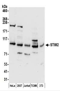 Detection of Human and Mouse STIM2 by Western Blot. Samples: Whole cell lysate (50 ug) prepared using NETN buffer from HeLa, 293T, Jurkat, mouse TCMK-1, and mouse NIH3T3 cells. Antibodies: Affinity purified rabbit anti-STIM2 antibody used for WB at 0.4 ug/ml. Detection: Chemiluminescence with an exposure time of 30 seconds.