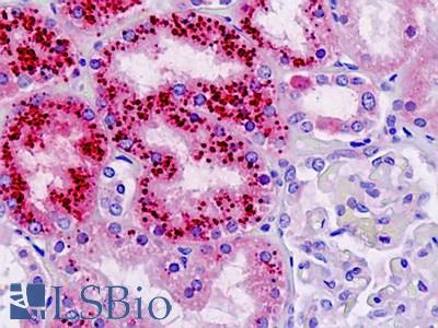 Anti-STIM2 antibody IHC staining of human kidney. Immunohistochemistry of formalin-fixed, paraffin-embedded tissue after heat-induced antigen retrieval.
