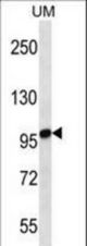 STIM2 Antibody western blot of uterus tumor cell line lysates (35 ug/lane). The STIM2 antibody detected the STIM2 protein (arrow).