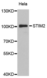 Western blot blot of extracts of HeLa cell line, using STIM2 antibody.