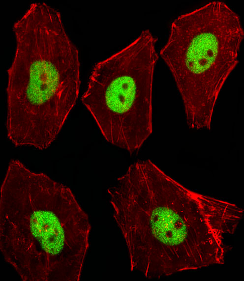 Fluorescent image of A549 cells stained with XAF1 Mouse Stk11 Antibody. Antibody was diluted at 1:100 dilution. An Alexa Fluor 488-conjugated goat anti-rabbit lgG at 1:400 dilution was used as the secondary antibody (green). Cytoplasmic actin was counterstained with Alexa Fluor 555 conjugated with Phalloidin (red).