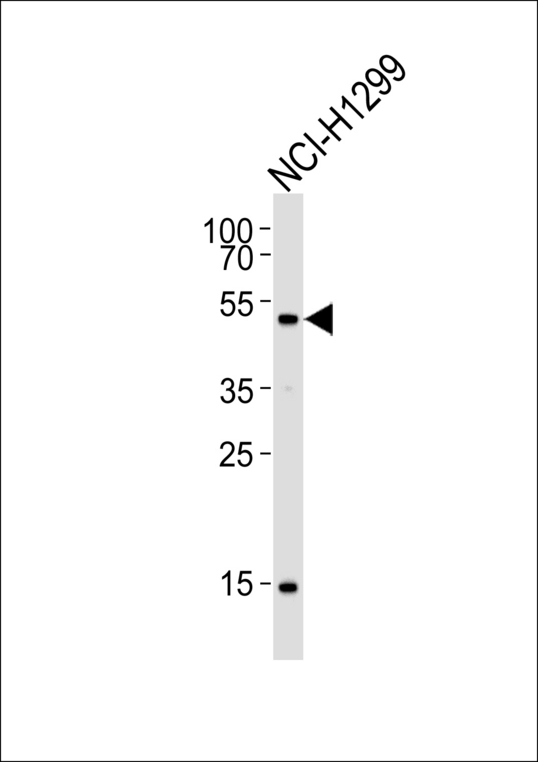 Western blot of lysate from NCI-H1299 cell line, using Mouse Stk11 Antibody. Antibody was diluted at 1:1000. A goat anti-rabbit IgG H&L (HRP) at 1:5000 dilution was used as the secondary antibody. Lysate at 35ug.