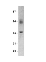 WB: Whole rat brain preparations were probed with anti-STEP, clone 23E5 (1:5000 dilution)