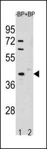 Western blot of STK25 Antibody antibody pre-incubated without(lane 1) and with(lane 2) blocking peptide in A549 cell line lysate. STK25 Antibody (arrow) was detected using the purified antibody.