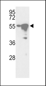 Western blot of hYSK-H340 in Ramos and HepG2 cell line lysates (35 ug/lane). YSK (arrow) was detected using the purified antibody.