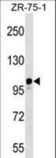 STK31 Antibody (N1002) western blot of ZR-75-1 cell line lysates (35 ug/lane). The STK31 antibody detected the STK31 protein (arrow).