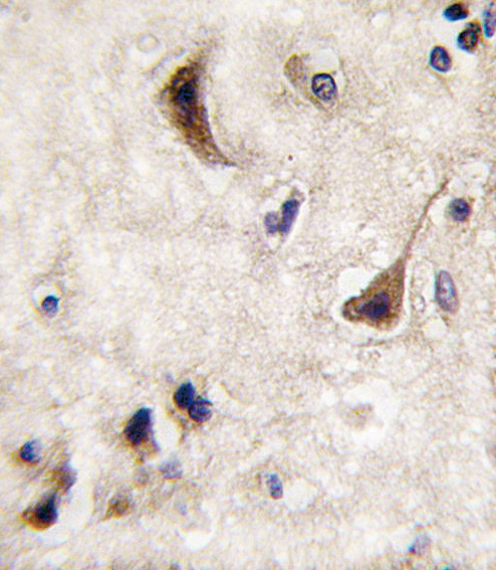 Formalin-fixed and paraffin-embedded human brain tissue reacted with STEP antibody , which was peroxidase-conjugated to the secondary antibody, followed by DAB staining. This data demonstrates the use of this antibody for immunohistochemistry; clinical relevance has not been evaluated.