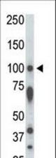 The anti-STK31 antibody is used in Western blot to detect STK31 in rat testis tissue lysate.