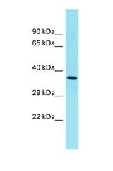Western blot of Human Thyroid Tumor. STK32A antibody dilution 1.0 ug/ml.