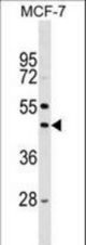 Mouse Stk32a Antibody western blot of MCF-7 cell line lysates (35 ug/lane). The Stk32a antibody detected the Stk32a protein (arrow).