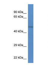 STK32B antibody LS-C135288 Western blot of Mouse Brain lysate. Antibody concentration 1 ug/ml.