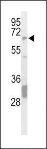 Western blot of hSTEP-Q155 in mouse brain tissue lysates (35 ug/lane). STEP (arrow) was detected using the purified Pab
