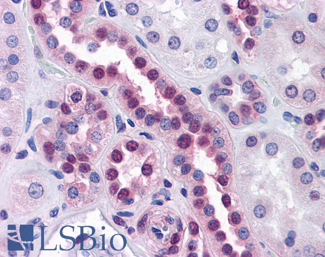 Anti-STK33 antibody IHC of human kidney. Immunohistochemistry of formalin-fixed, paraffin-embedded tissue after heat-induced antigen retrieval. Antibody LS-B4535 concentration 10 ug/ml.