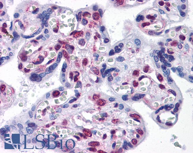 Anti-STK33 antibody IHC of human placenta. Immunohistochemistry of formalin-fixed, paraffin-embedded tissue after heat-induced antigen retrieval. Antibody LS-B4535 concentration 10 ug/ml.
