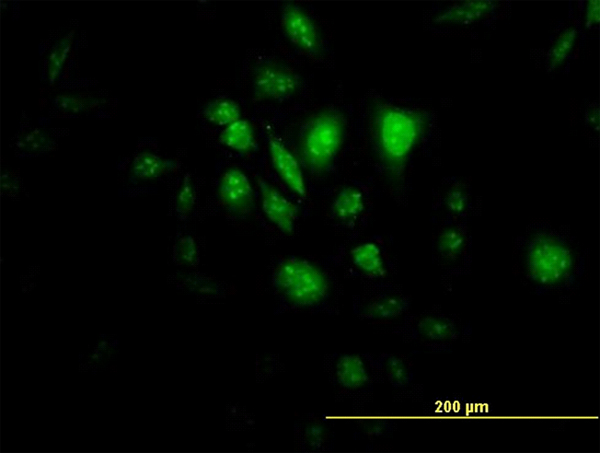 Immunofluorescence of monoclonal antibody to STK33 on HeLa cell (antibody concentration 10 ug/ml).