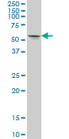 STK33 monoclonal antibody, clone 3F10 Western blot of STK33 expression in Jurkat.