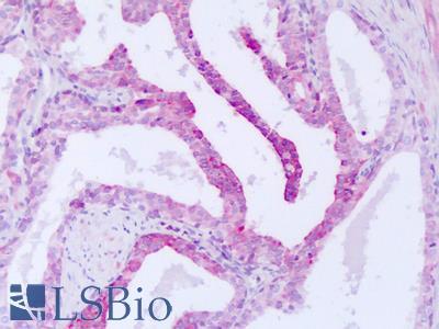 Anti-STK33 antibody IHC of human prostate. Immunohistochemistry of formalin-fixed, paraffin-embedded tissue after heat-induced antigen retrieval. Antibody LS-B8271 dilution 5-10 ug/ml.