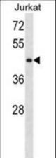 STK33 Antibody western blot of Jurkat cell line lysates (35 ug/lane). The STK33 antibody detected the STK33 protein (arrow).