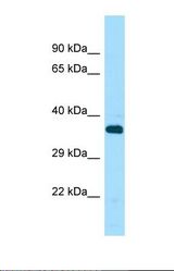 Western blot of Human THP-1. STK33 antibody dilution 1.0 ug/ml.