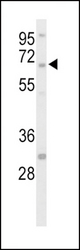 Western blot of hSTEP-Q155 in HepG2 cell line lysates (35 ug/lane). STEP (arrow) was detected using the purified antibody.
