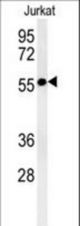 STK33-T481 western blot of NCI-H460 cell line lysates (35 ug/lane). The STK33 antibody detected the STK33 protein (arrow).