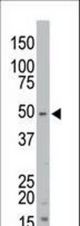 The anti-STK35 antibody is used in Western blot to detect STK35 in mouse kidney tissue lysate.
