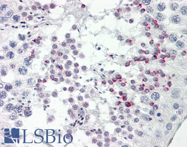 Anti-STK36 antibody IHC of human testis. Immunohistochemistry of formalin-fixed, paraffin-embedded tissue after heat-induced antigen retrieval. Antibody LS-B8588 dilution 5 ug/ml.
