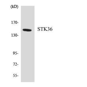 Western blot of the lysates from HepG2 cells using STK36 antibody.