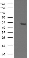 HEK293T cells were transfected with the pCMV6-ENTRY control (Left lane) or pCMV6-ENTRY STK38L (Right lane) cDNA for 48 hrs and lysed. Equivalent amounts of cell lysates (5 ug per lane) were separated by SDS-PAGE and immunoblotted with anti-STK38L.