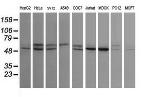 Western blot of extracts (35 ug) from 9 different cell lines by using g anti-STK38L monoclonal antibody (HepG2: human; HeLa: human; SVT2: mouse; A549: human; COS7: monkey; Jurkat: human; MDCK: canine; PC12: rat; MCF7: human).