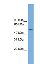 STK38L antibody LS-C116603 Western blot of ACHN lysate.