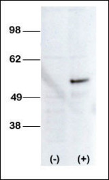 Western blot of anti-STK38L antibody transiently transfected HEK-293 cell line lysate (1 ug/lane). STK38L antibody(arrow) was detected using the purified Pab