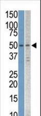 The anti-STK38L antibody is used in Western blot to detect STK38L in Jurkat and T47D cell line lysates.