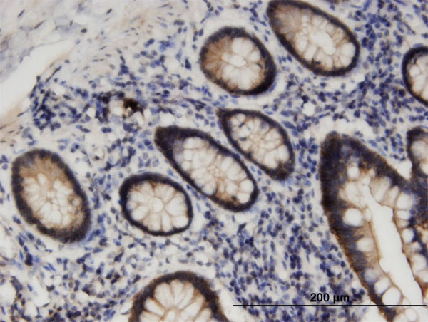 Immunoperoxidase of monoclonal antibody to STK38L on formalin-fixed paraffin-embedded human small Intestine. [antibody concentration 3 ug/ml]