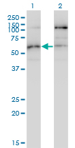Western blot of STK38L expression in transfected 293T cell line by STK38L monoclonal antibody (M01), clone 4E5.