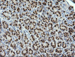 IHC of paraffin-embedded Human pancreas tissue using anti-STK38L mouse monoclonal antibody.