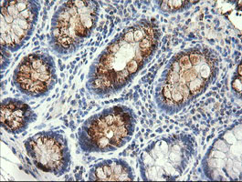 IHC of paraffin-embedded Human colon tissue using anti-STK38L mouse monoclonal antibody.