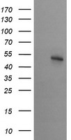 HEK293T cells were transfected with the pCMV6-ENTRY control (Left lane) or pCMV6-ENTRY STK38L (Right lane) cDNA for 48 hrs and lysed. Equivalent amounts of cell lysates (5 ug per lane) were separated by SDS-PAGE and immunoblotted with anti-STK38L.