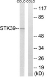 Western blot of extracts from COLO205 cells, using STK39 Antibody. The lane on the right is treated with the synthesized peptide.