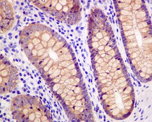 IHC of paraffin-embedded human colon tissue using anti-SPAK antibody.