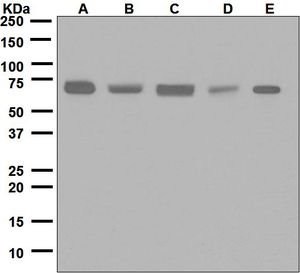 Western blot analysis on (A) SH-SY5Y, (B) 293T, (C) Jurkat, (D) BxPC-3, and (E) HepG2 cell lysates using anti-SPAK antibody.