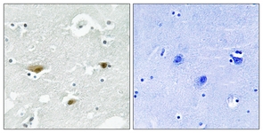 IHC of paraffin-embedded human brain, using STK39 (Phospho-Ser325) Antibody. The sample on the right was incubated with synthetic peptide.