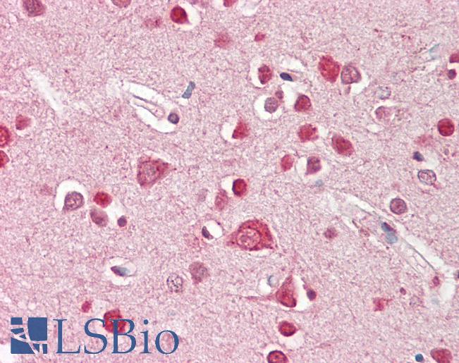 Anti-STK39 / SPAK antibody IHC of human brain, cortex. Immunohistochemistry of formalin-fixed, paraffin-embedded tissue after heat-induced antigen retrieval. Antibody LS-B8310 dilution 3.75 ug/ml.