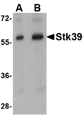 Western blot of Stk39 in rat brain tissue lysate with Stk39 antibody at (A) 1 and (B) 2 ug/ml