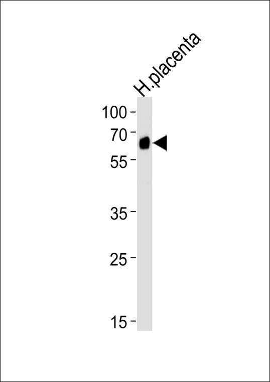 STK39 Antibody western blot of human placenta tissue lysates (35 ug/lane). The STK39 antibody detected the STK39 protein (arrow).