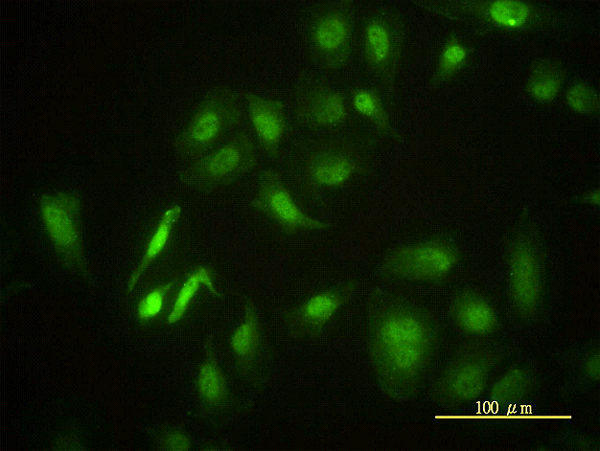 Immunofluorescence of monoclonal antibody to STK4 on HeLa cell. [antibody concentration 10 ug/ml]