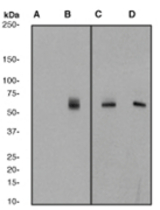 Western blot analysis on HeLa cell lysates using anti-Phospho-Mst1 (pT183)/ Mst2 (pT180) antibody, 1:2000 dilution (A, B); Mst1 (1941-1), 1:5000 dilution (C, D) Cells were either (A, C) untreated or (B, D) treated with Calyculin A.