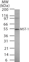 Western blot of MST-1 in 15 ugs of Jurkat cell lysate using antibody at 1 ug/ml.