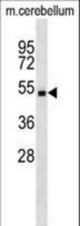 Mouse Stk4 Antibody western blot of mouse cerebellum tissue lysates (35 ug/lane). The Stk4 antibody detected the Stk4 protein (arrow).