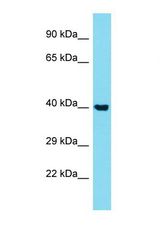 Western blot of Human A549 . STK40 antibody dilution 1.0 ug/ml.